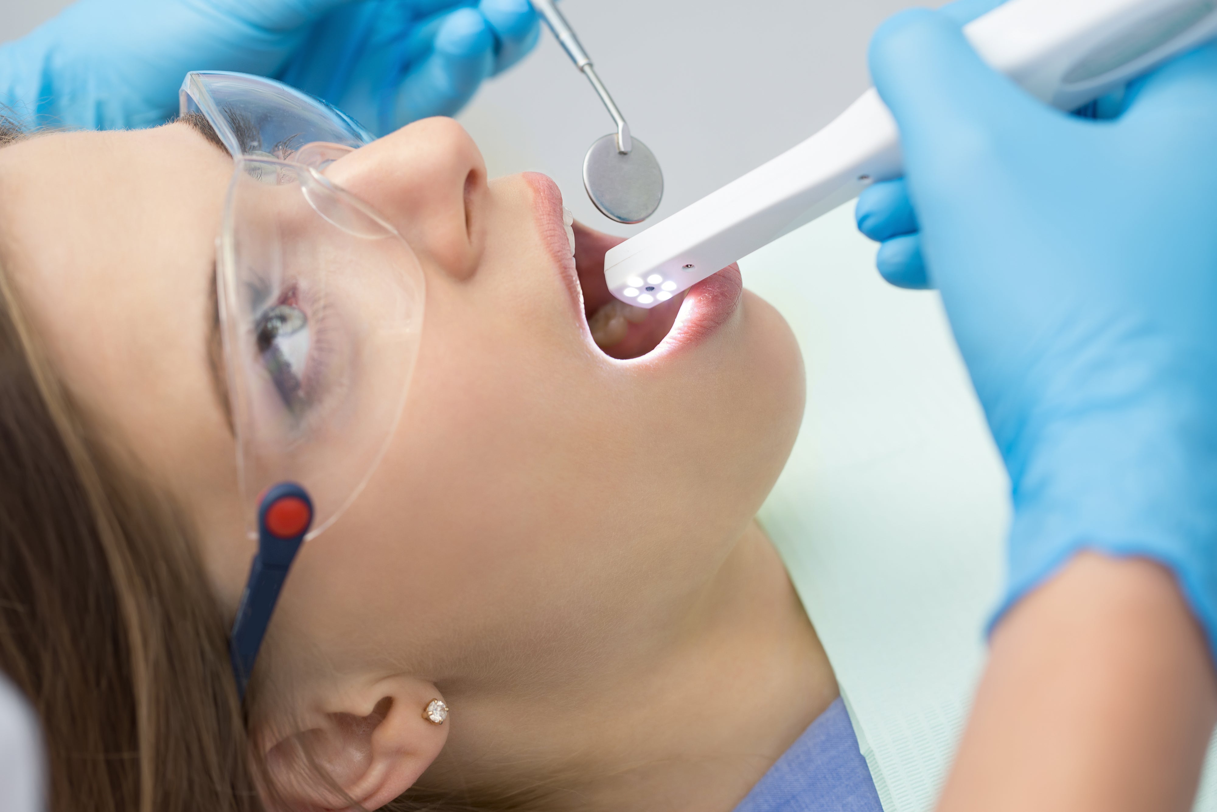 Introduction to intraoral cameras: What are they and how do they work?